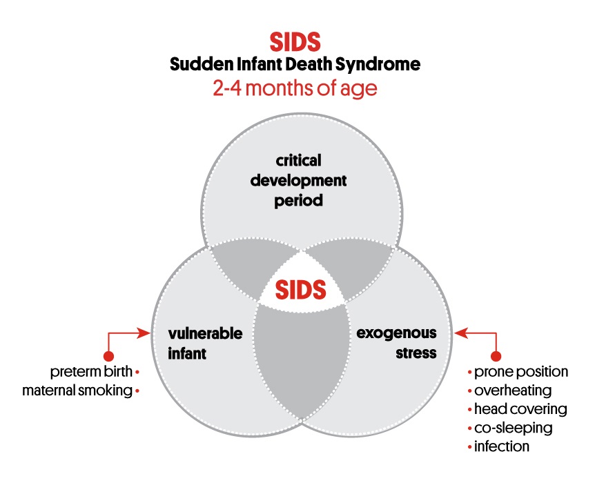 Sids Risk By Month Chart 2017