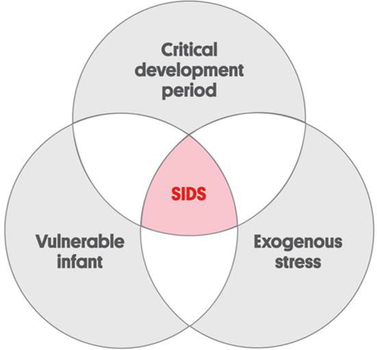 Figure 1 Triple Risk Model for SIDS, illustrating the three overlapping factors: (1) a vulnerable infant; (2) a critical developmental period where the peak incidence of SIDS is 2-4 months; and (3) an exogenous stress 