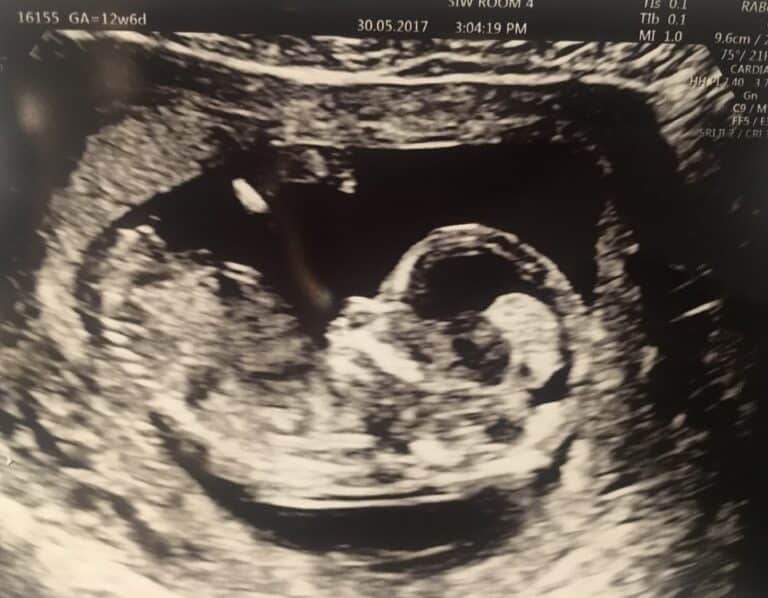 Dr. Nelu's ultrasound of her son
